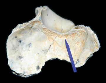 Homo erectus skull