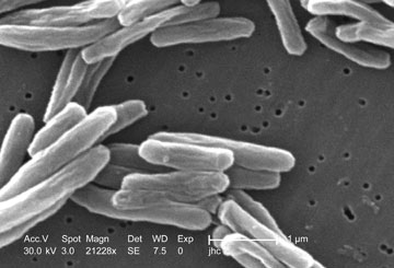 Mycobacterium tuberculosis